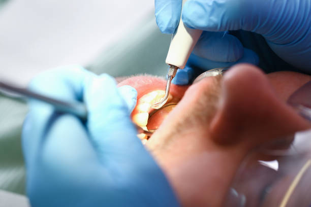 Best Weekend Emergency Dentist in Old Hill, CT