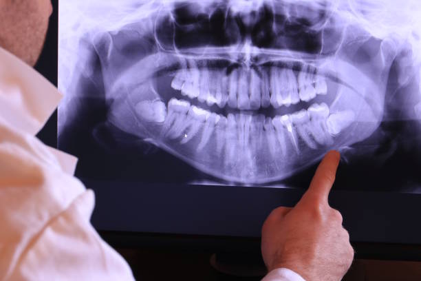 Best Emergency Dentist for Lost Fillings or Crowns in Old Hill, CT