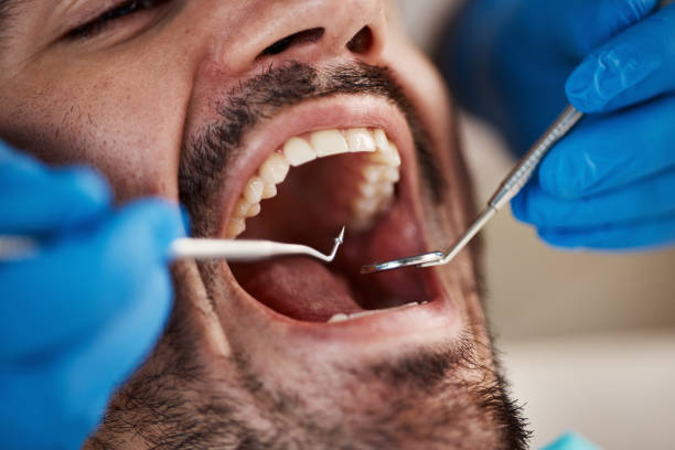 Best Emergency Dentist for Knocked-Out Tooth in Old Hill, CT